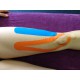 Cursus Sijmoves Medical Taping Compleet